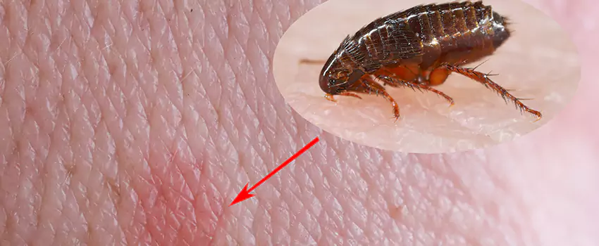 Flea Control for Humans Hemet, CA